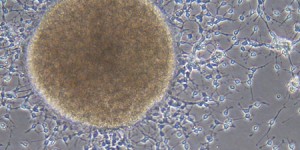 Protected: Amniotic Fluid